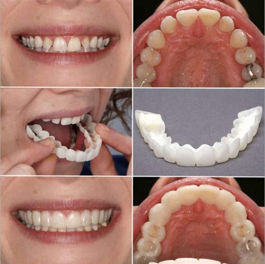 MAH FITGEAR Instant & Confident Smile Fit Flex Cosmetic Denture Teeth | Natural-Looking Removable Teeth for Men & Women