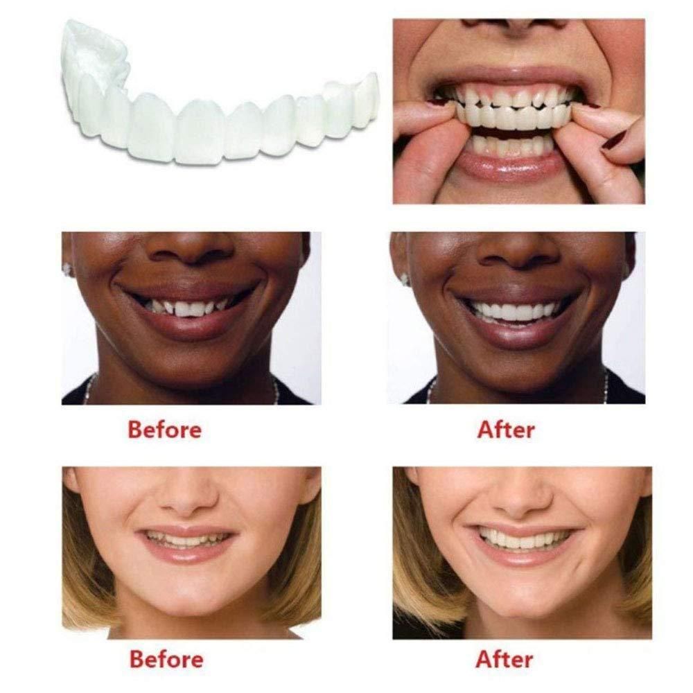 MAH FITGEAR Instant & Confident Smile Fit Flex Cosmetic Denture Teeth | Natural-Looking Removable Teeth for Men & Women